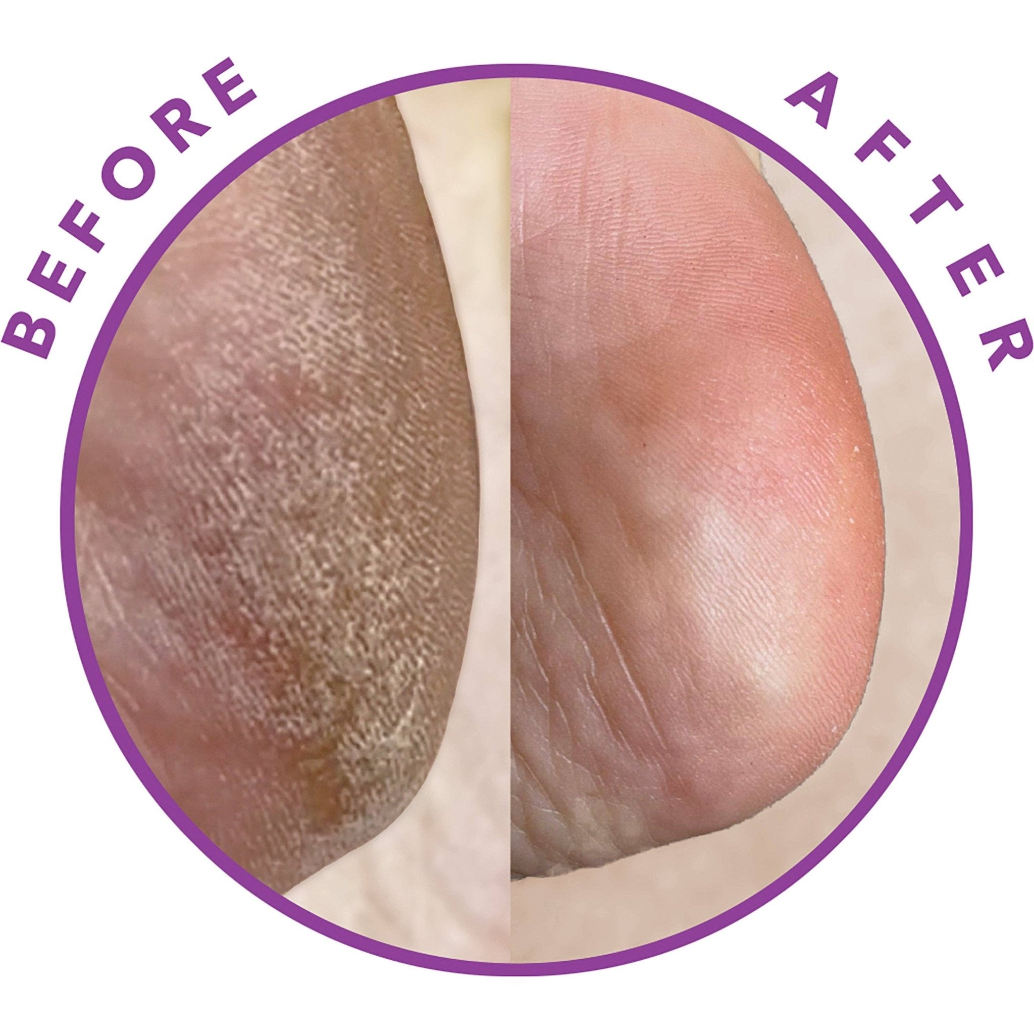 Barefoot Scientist - Reboot | A FACIAL FOR YOUR FEET. - The Look and Co