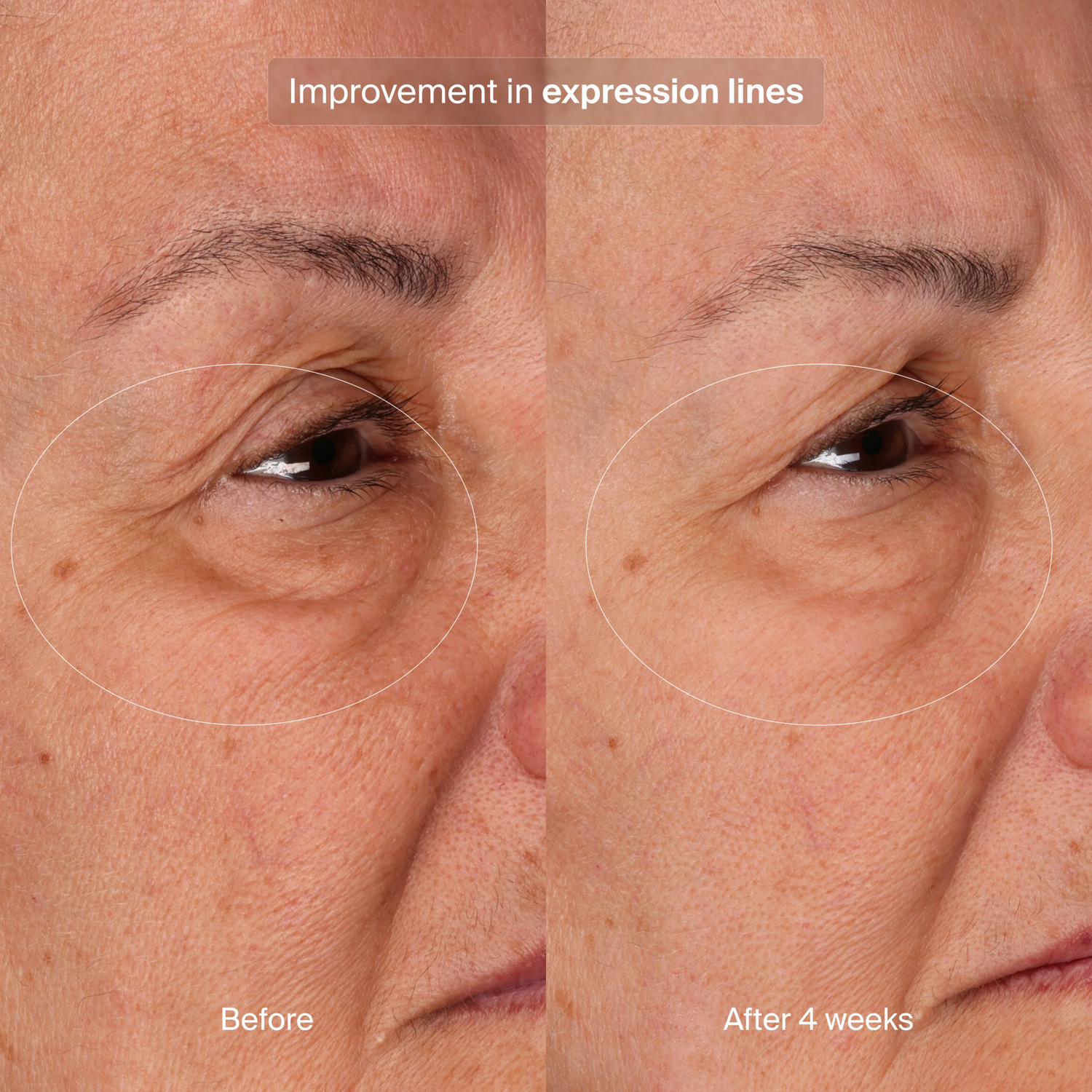 Bioadapitive Stress Repair Refille - The Look and Co