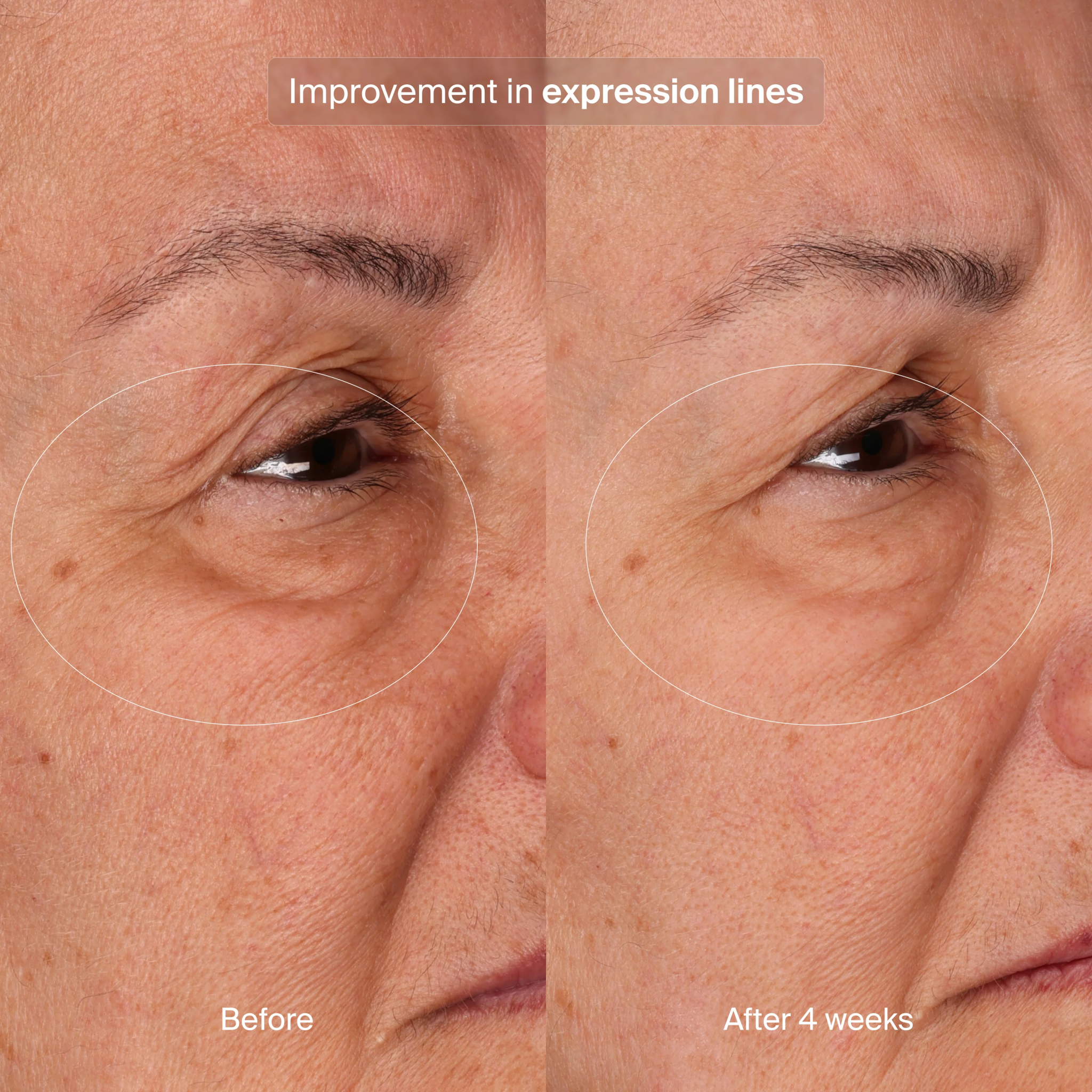 Bioadapitive Stress Repair Refille - The Look and Co