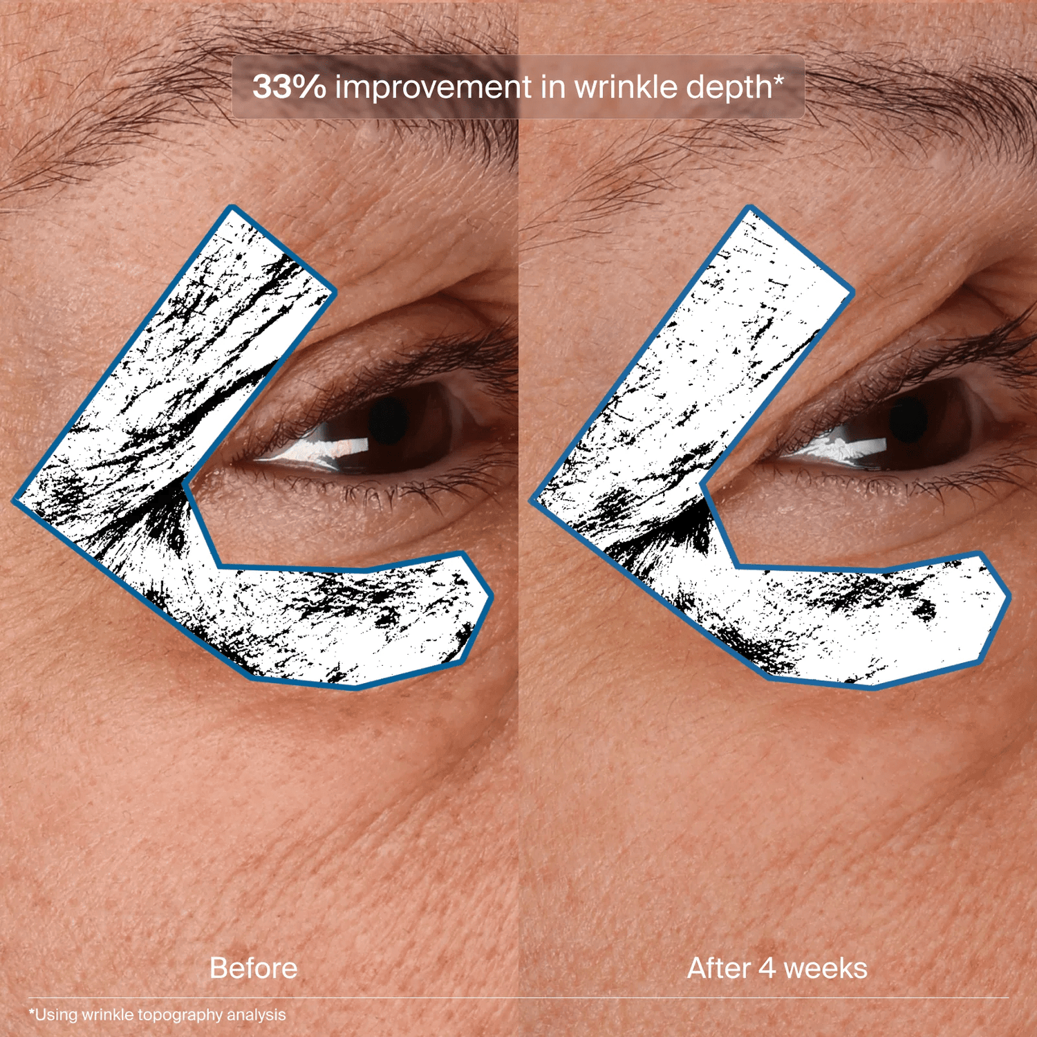 Bioadapitive Stress Repair Refille - The Look and Co