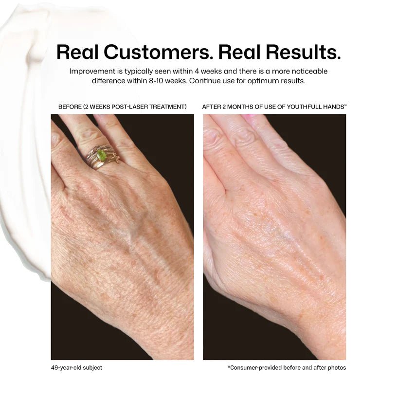 Revision Skincare YouthFull Hands - The Look and Co