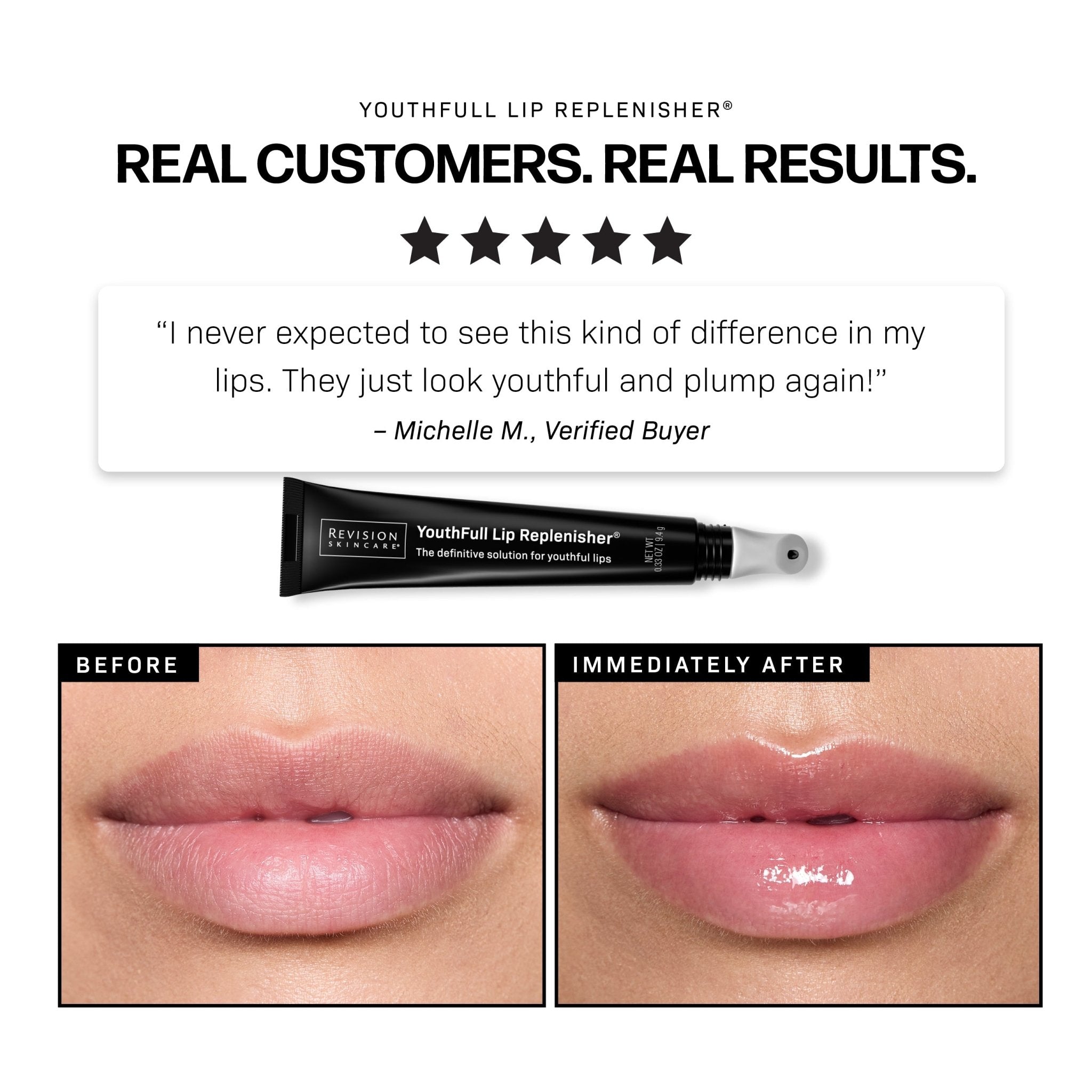 Revision Skincare YouthFull Lip Replenisher - The Look and Co