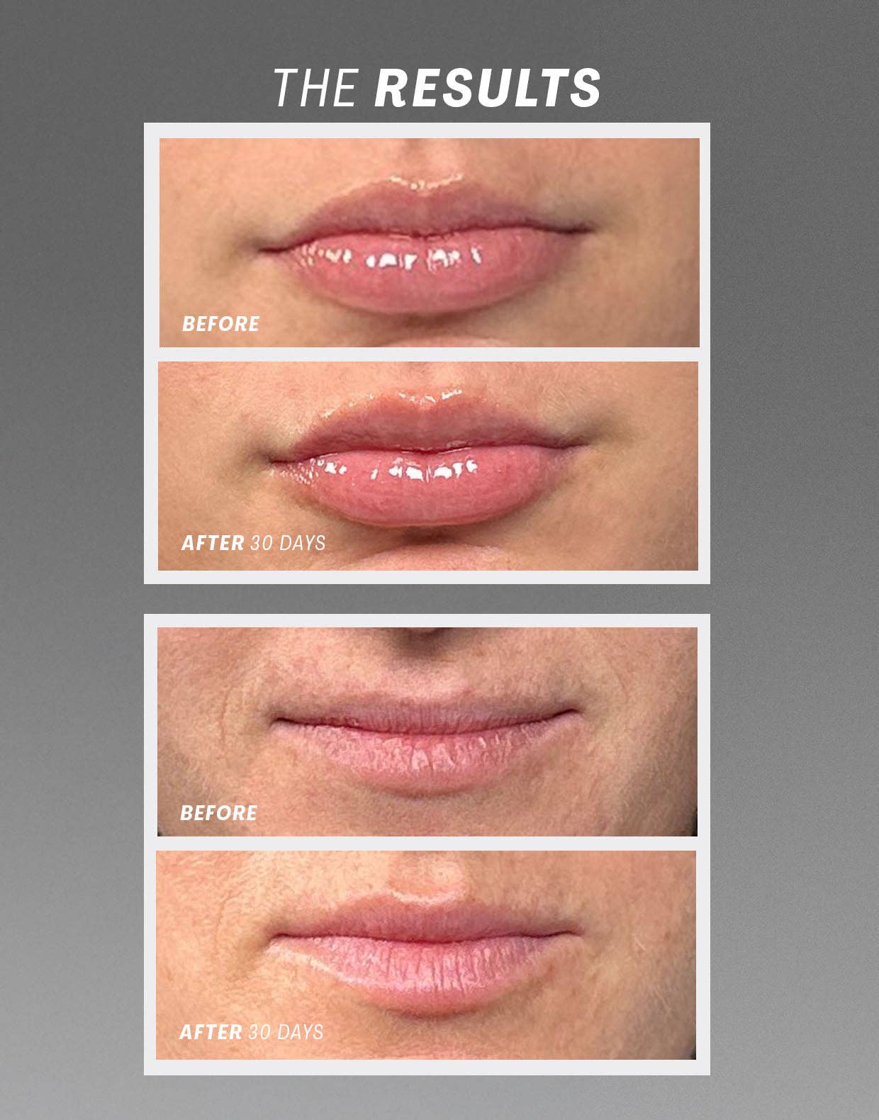 The Outset - Lip Oasisᵀᴹ Glossy Treatment - The Look and Co