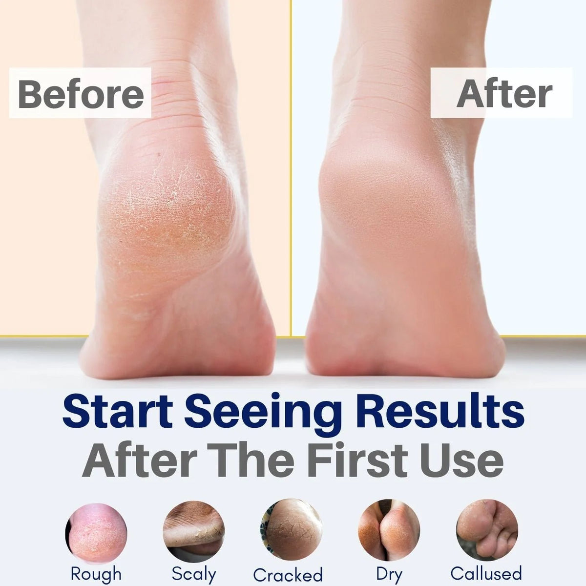 The Yellow Bird - All Natural Foot Cream - The Look and Co