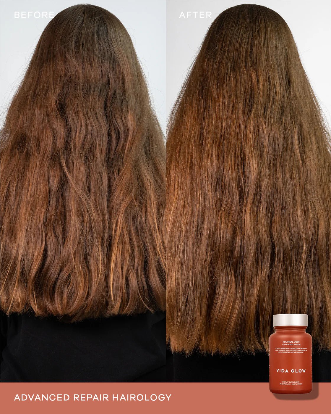 Vida Glow Hairology Capsules - The Look and Co