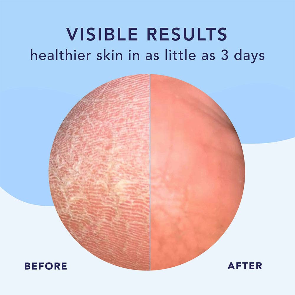 Barefoot Scientist - High Dive | Intensive hydration for smoother feet - The Look and Co