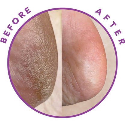 Barefoot Scientist - Reboot | A FACIAL FOR YOUR FEET. - The Look and Co