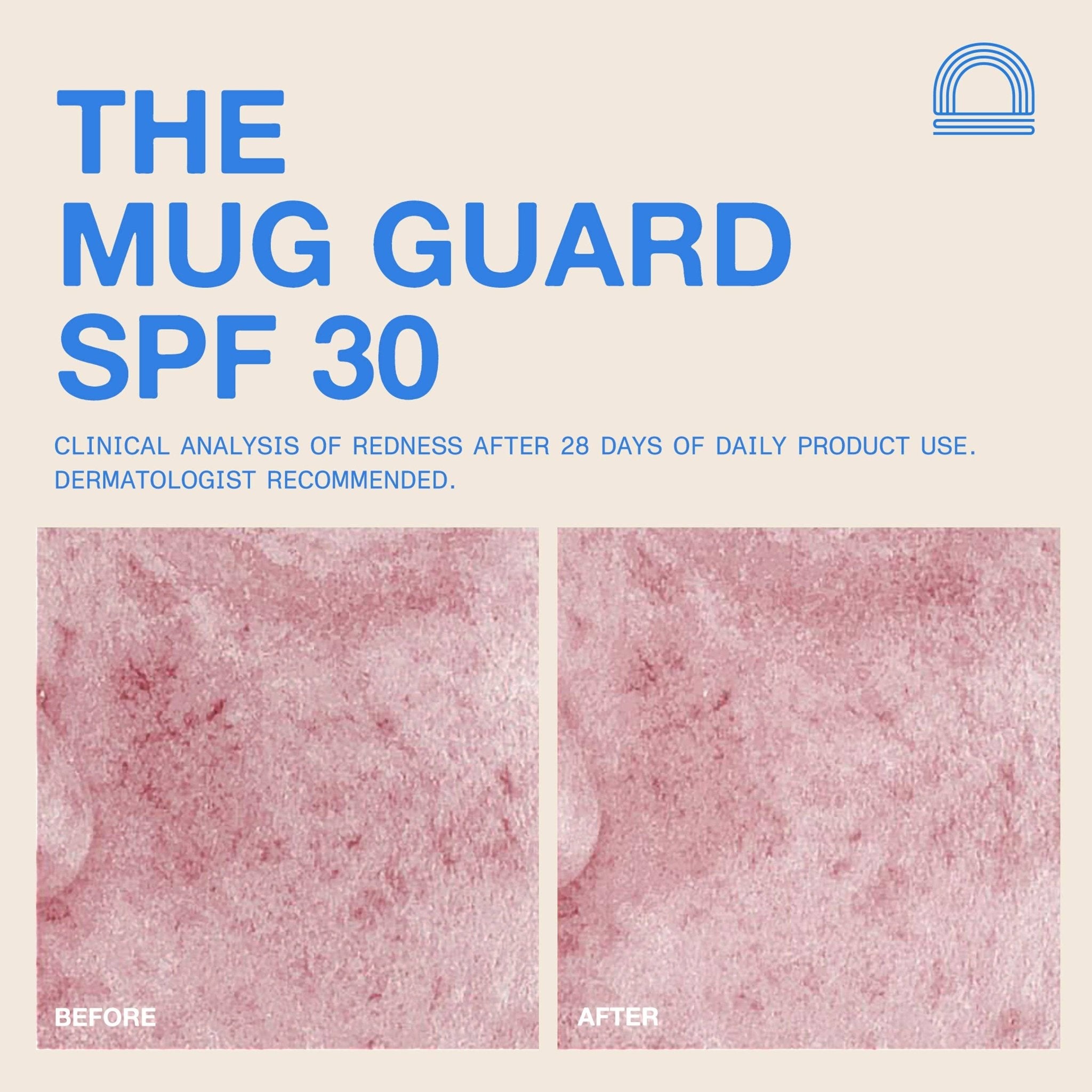 DUNE Suncare - The Mug Guard - The Look and Co