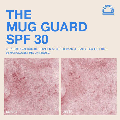 DUNE Suncare - The Mug Guard - The Look and Co