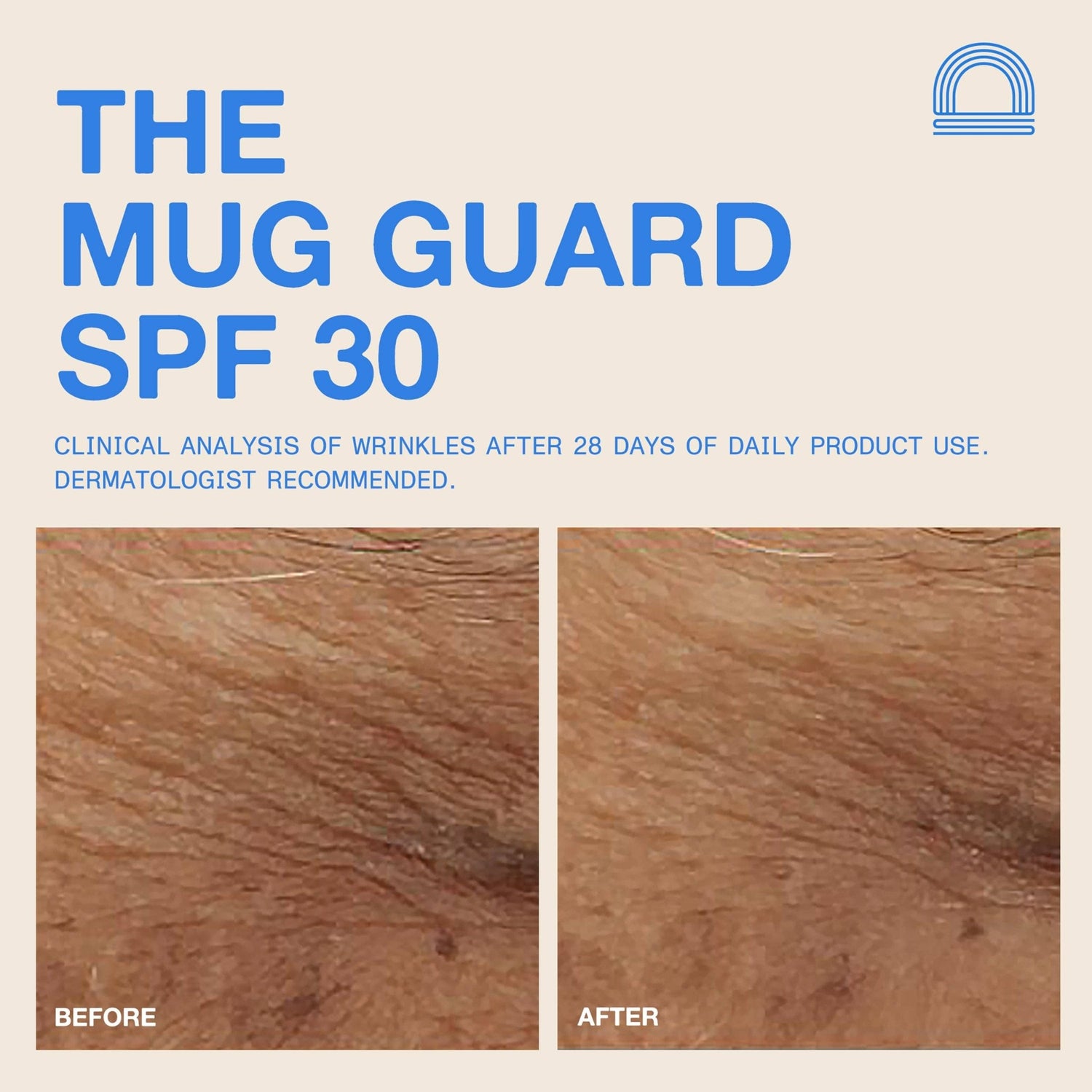 DUNE Suncare - The Mug Guard - The Look and Co