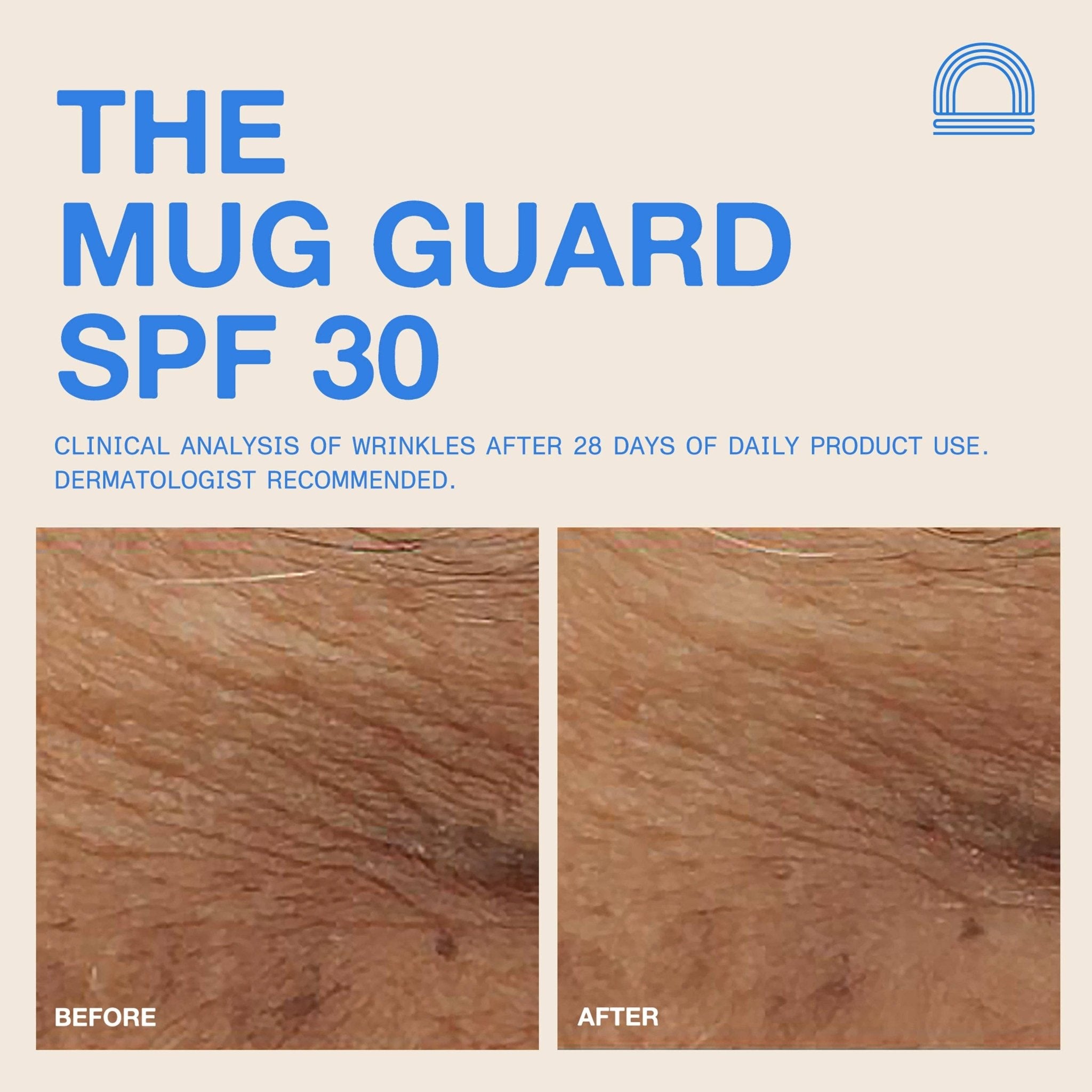 DUNE Suncare - The Mug Guard - The Look and Co