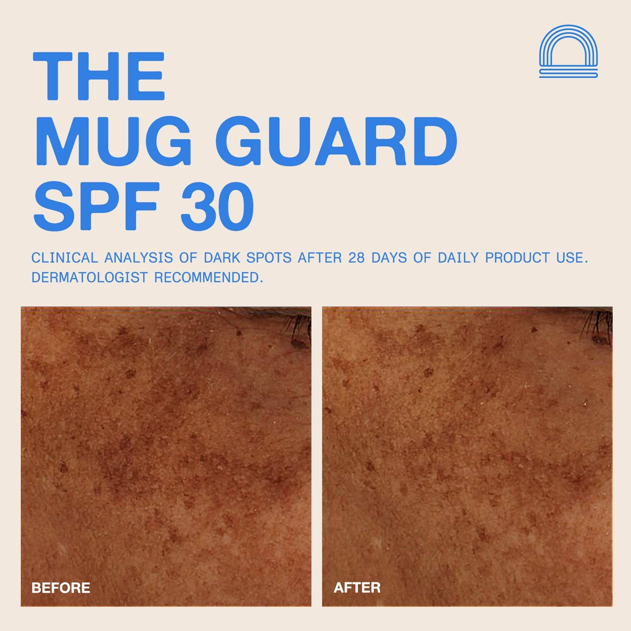 DUNE Suncare - The Mug Guard - The Look and Co