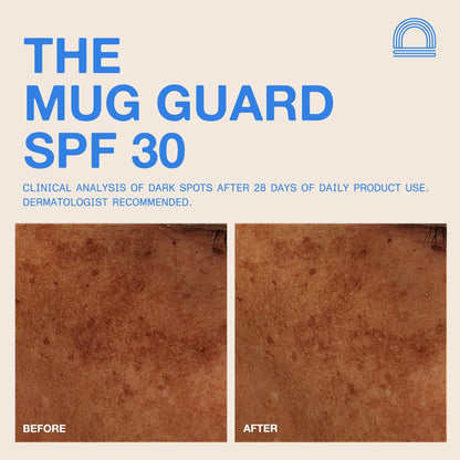 DUNE Suncare - The Mug Guard - The Look and Co