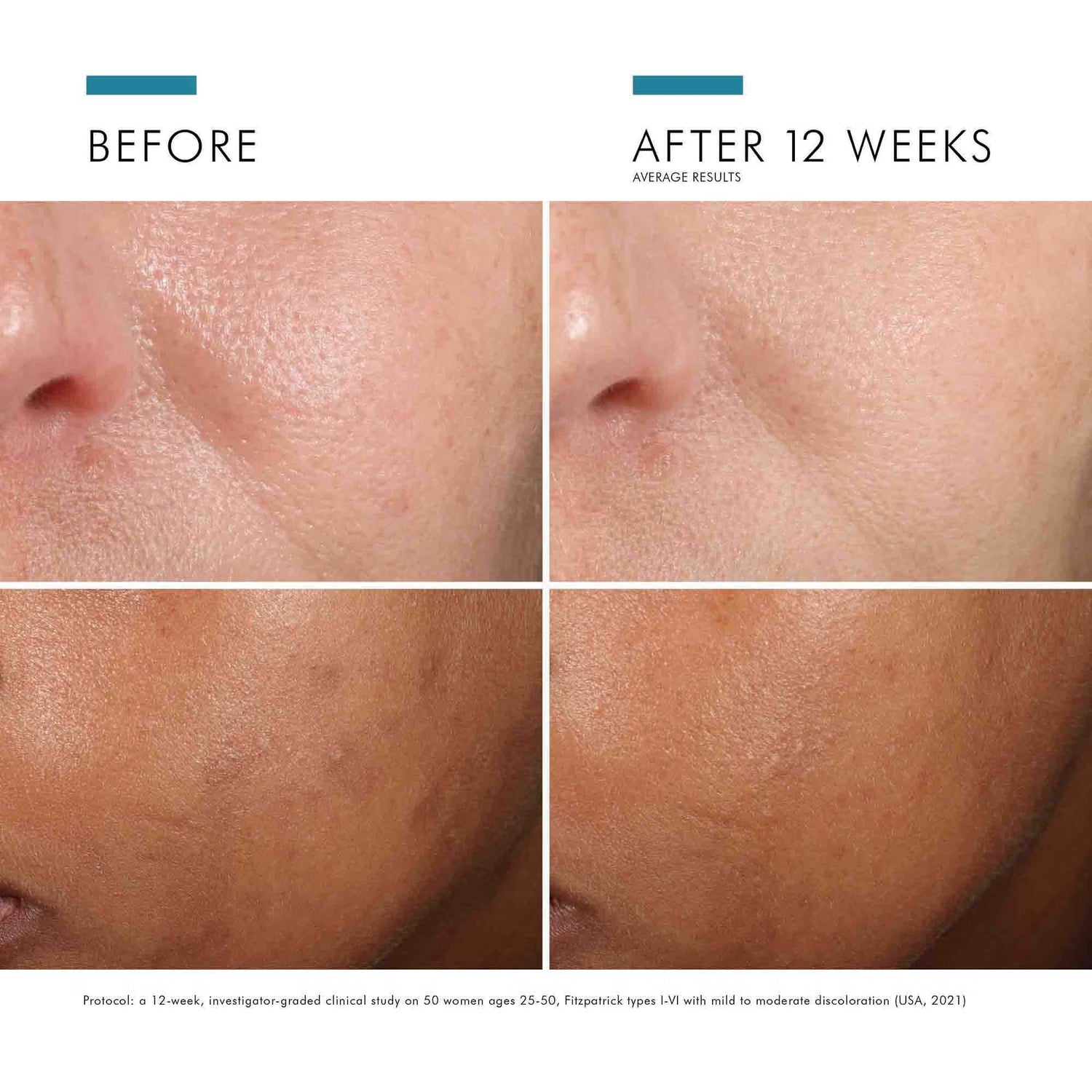 SkinCeuticals Phloretin CF with Ferulic Acid