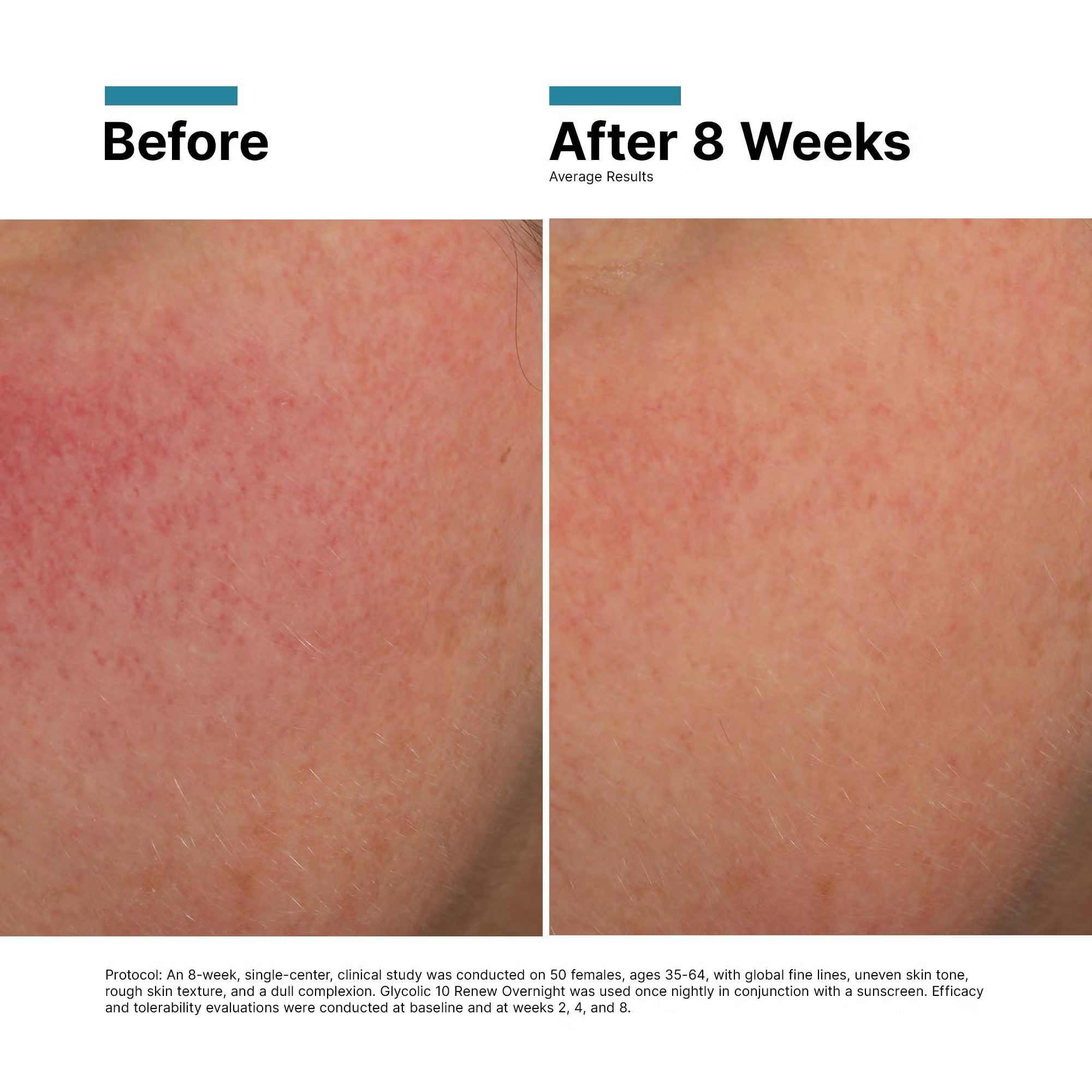 SkinCeuticals Glycolic 10 Renew Overnight