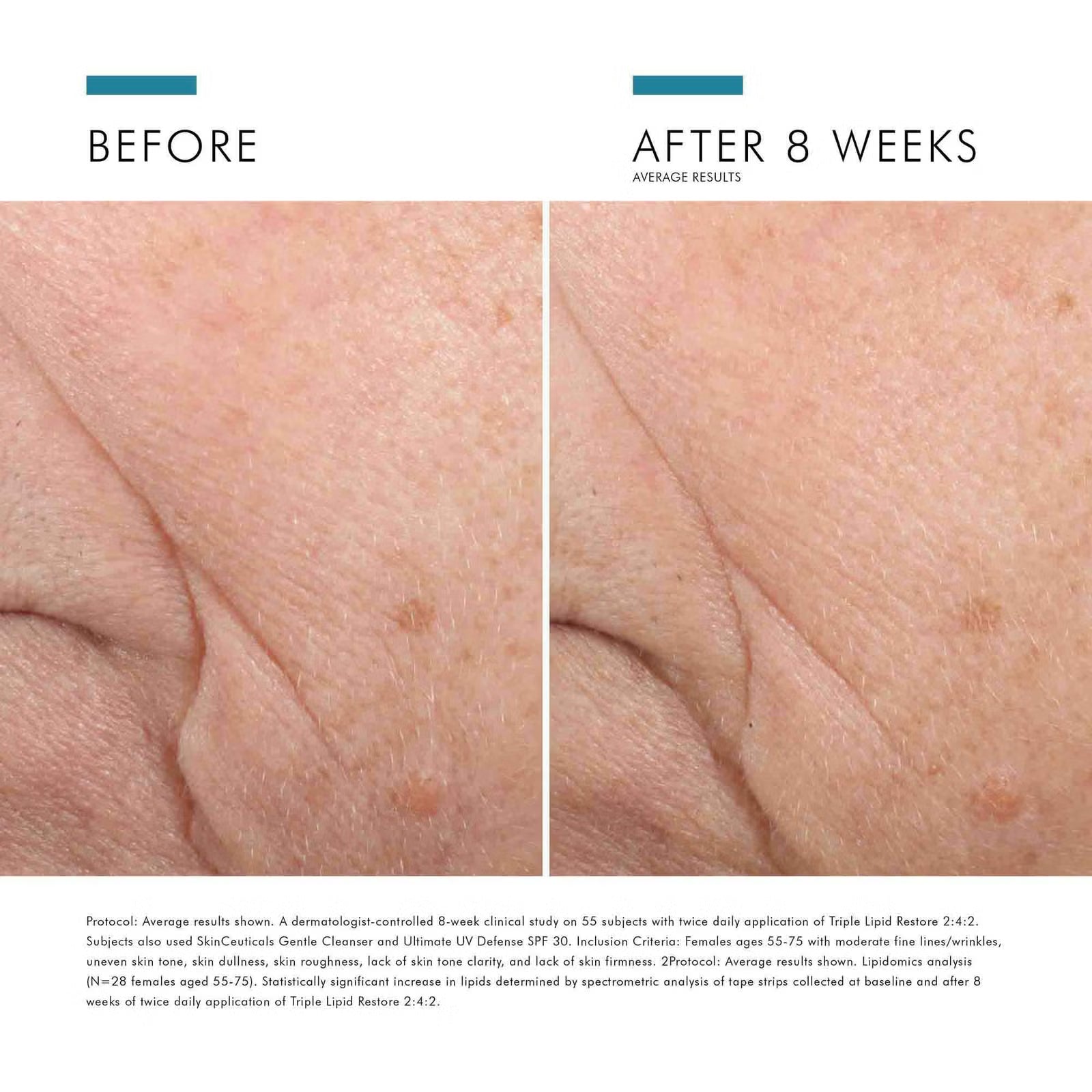 SkinCeuticals Triple Lipid Restore