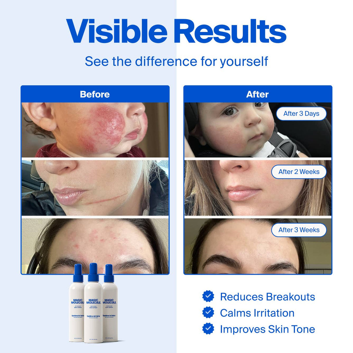 Magic Molecule - Magic Molecule Hypochlorous Acid Spray: 18ct Mini 2oz - The Look and Co