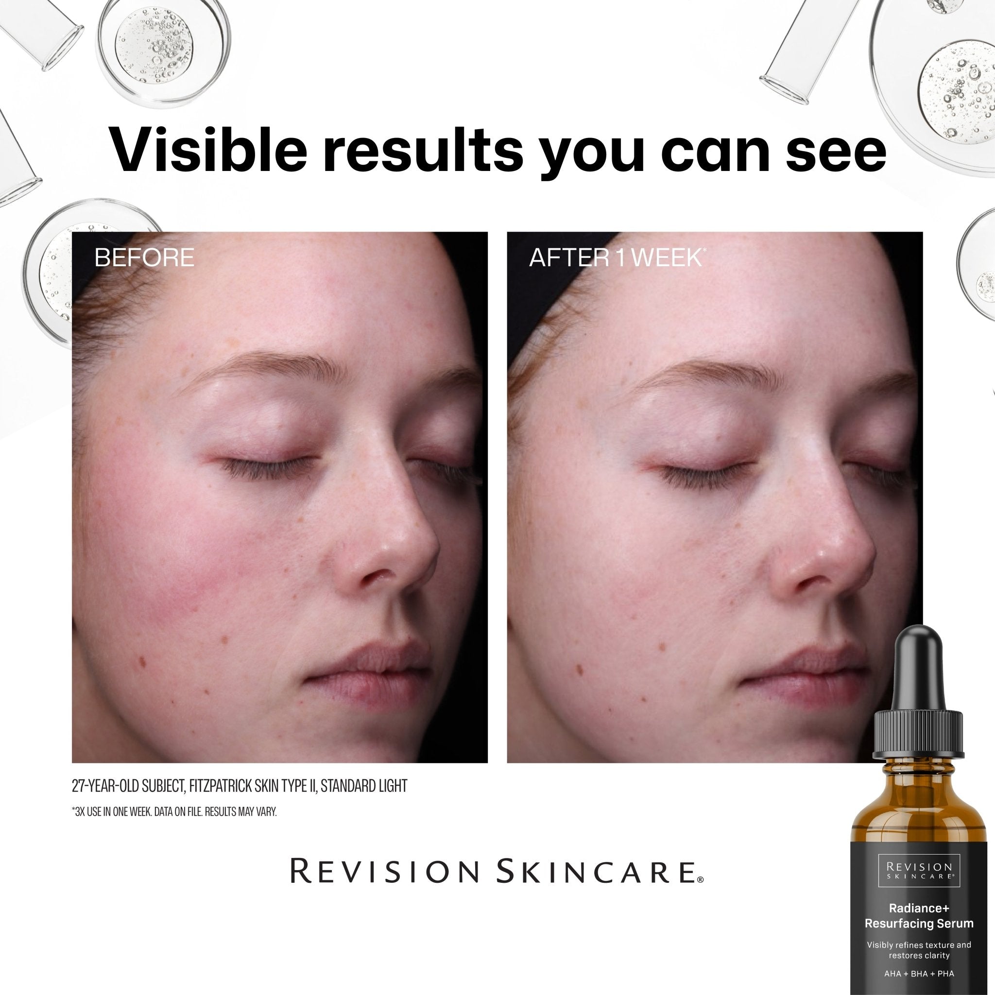 NEW! Revision Skincare Radiance+ Resurfacing Serum – The Look and Co