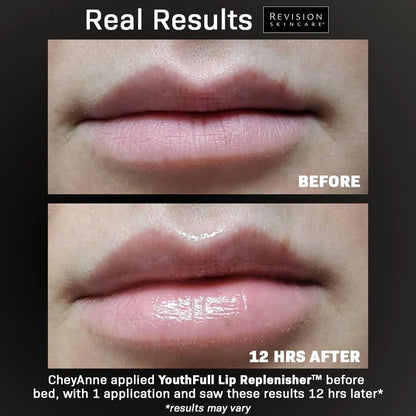 Revision Skincare YouthFull Lip Replenisher - The Look and Co