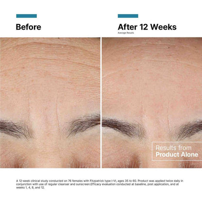 SkinCeuticals Advanced RGN - 6 Recovery Cream – Pro Size - The Look and Co