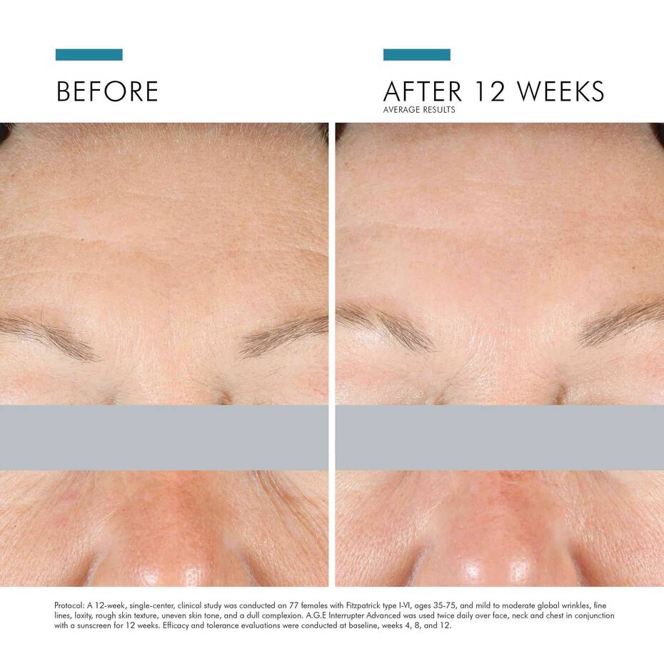 SkinCeuticals A.G.E. Interrupter Advanced Cream - The Look and Co