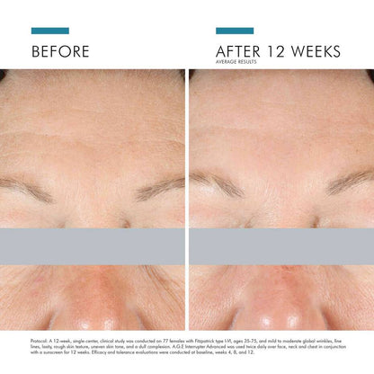 SkinCeuticals A.G.E. Interrupter Advanced Cream - The Look and Co