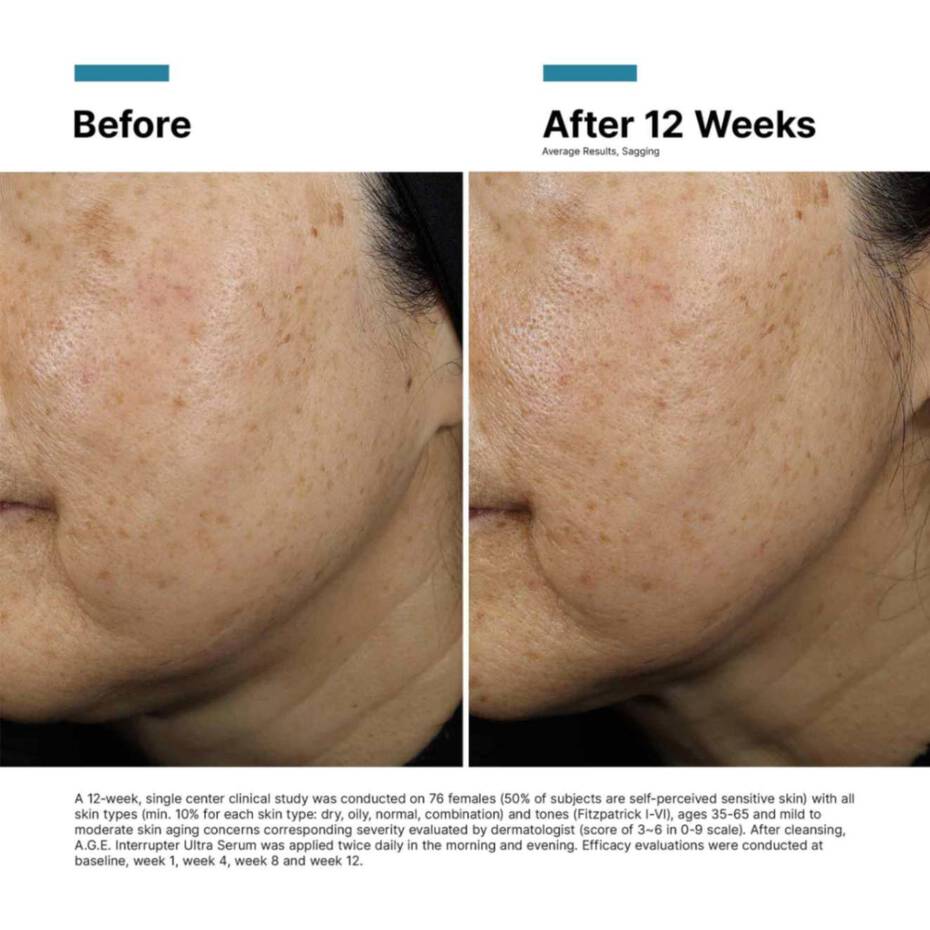 SkinCeuticals A.G.E. Interrupter Ultra Serum - The Look and Co