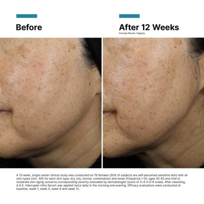 SkinCeuticals A.G.E. Interrupter Ultra Serum - The Look and Co