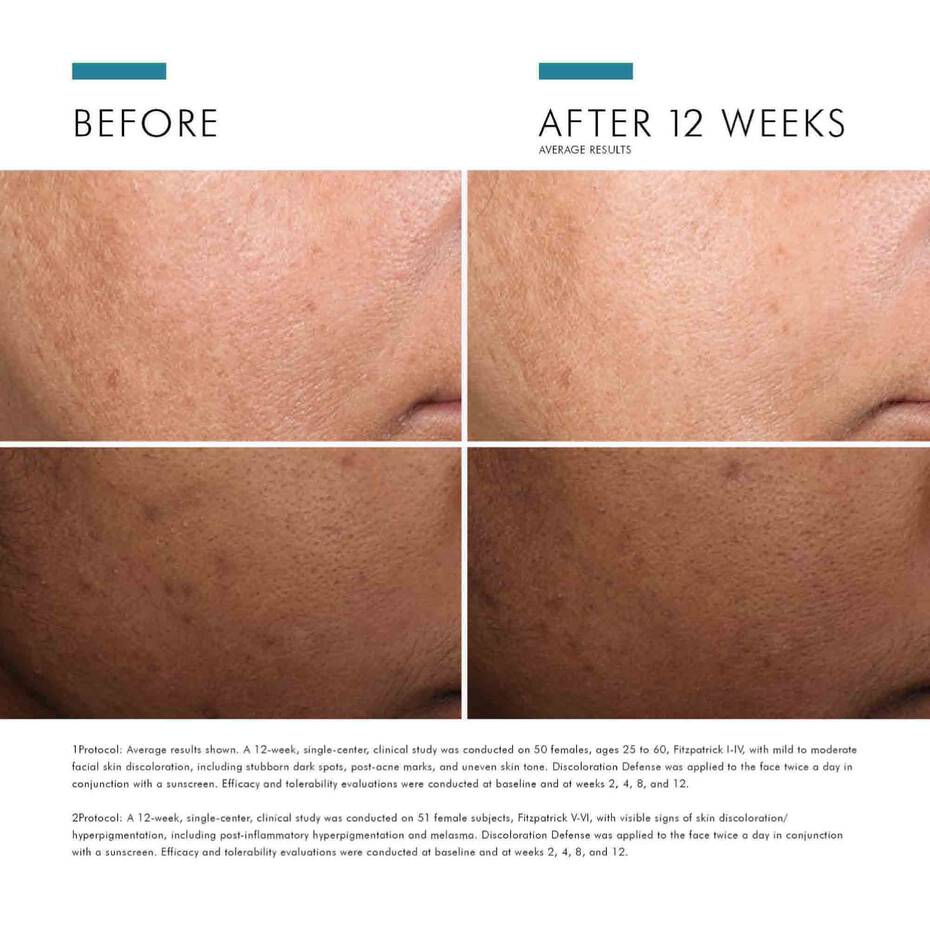 SkinCeuticals Discoloration Defense - The Look and Co