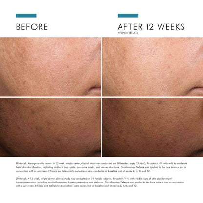 SkinCeuticals Discoloration Defense - The Look and Co