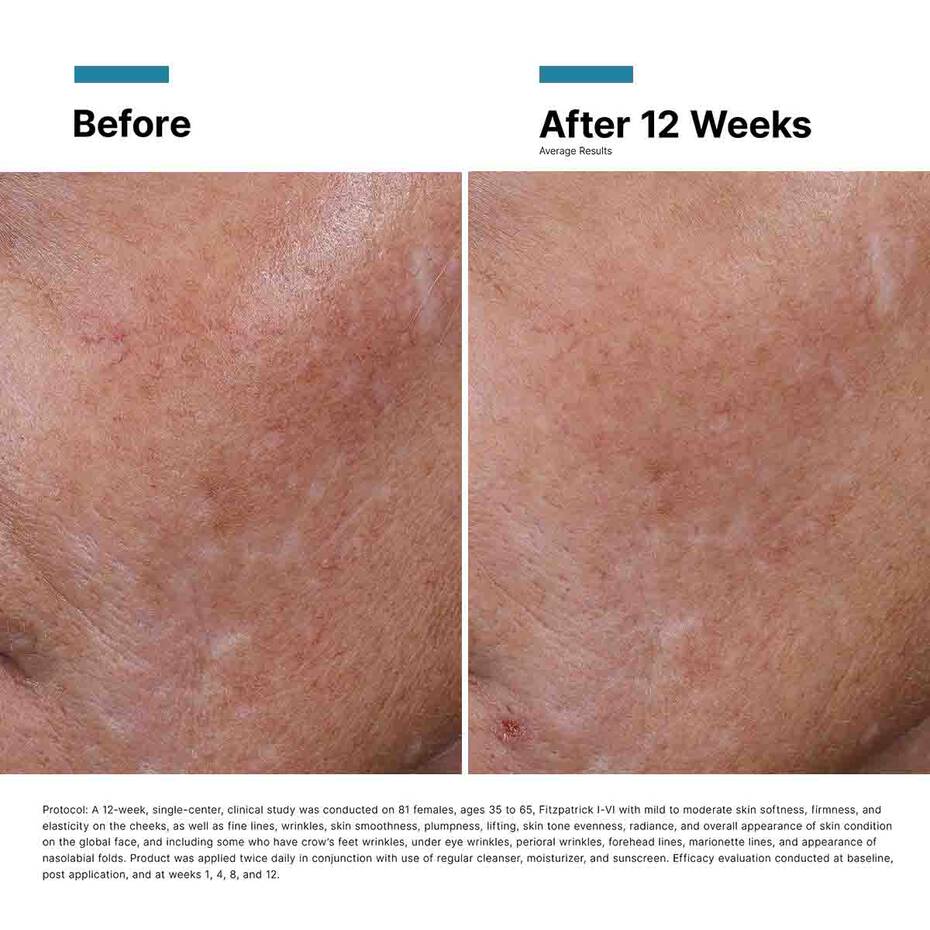 SkinCeuticals Hyaluronic Acid Intensifier Multi - Glycan - The Look and Co