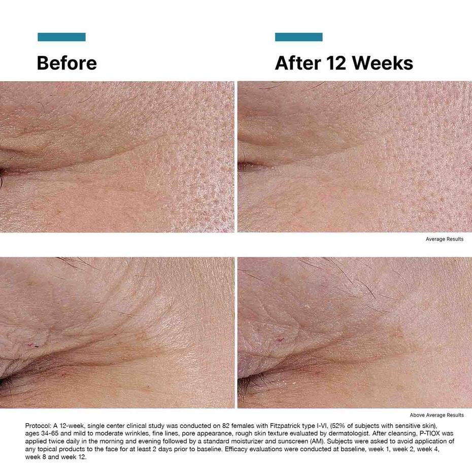 SkinCeuticals P - TIOX Peptide serum - The Look and Co
