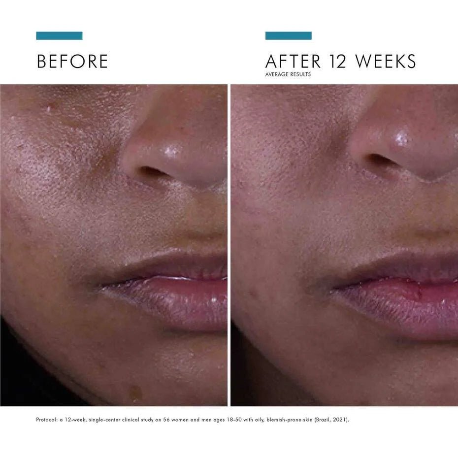SkinCeuticals Silymarin CF - The Look and Co