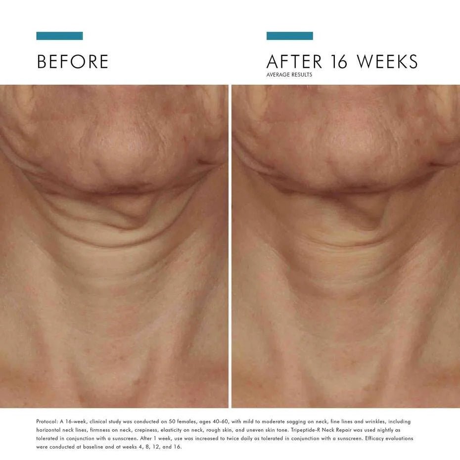 SkinCeuticals Tripeptide - R Neck Repair - The Look and Co