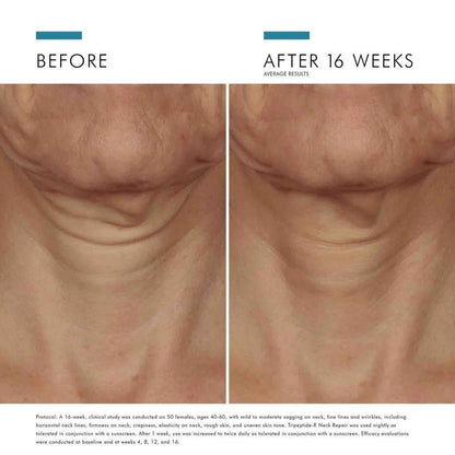 SkinCeuticals Tripeptide - R Neck Repair - The Look and Co