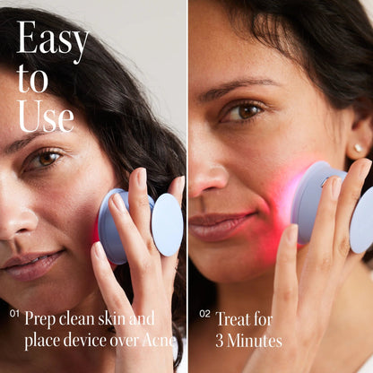 Solawave Bye Acne Spot Treatment - The Look and Co