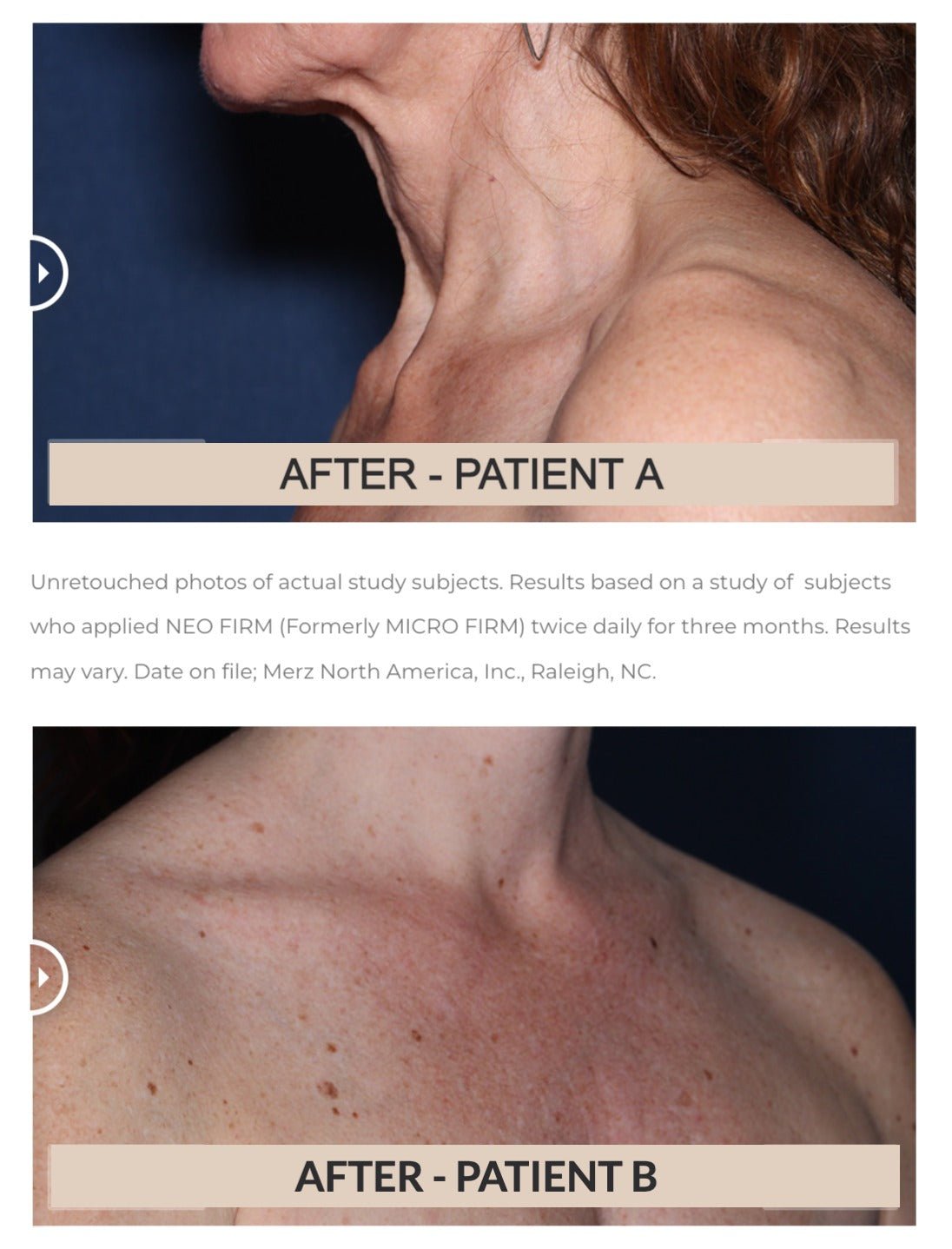 Neocutis Neo Firm Neck &amp; Décolleté Tightening Cream - The Look and Co