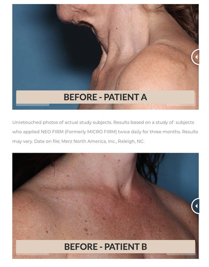 Neocutis Neo Firm Neck &amp; Décolleté Tightening Cream - The Look and Co